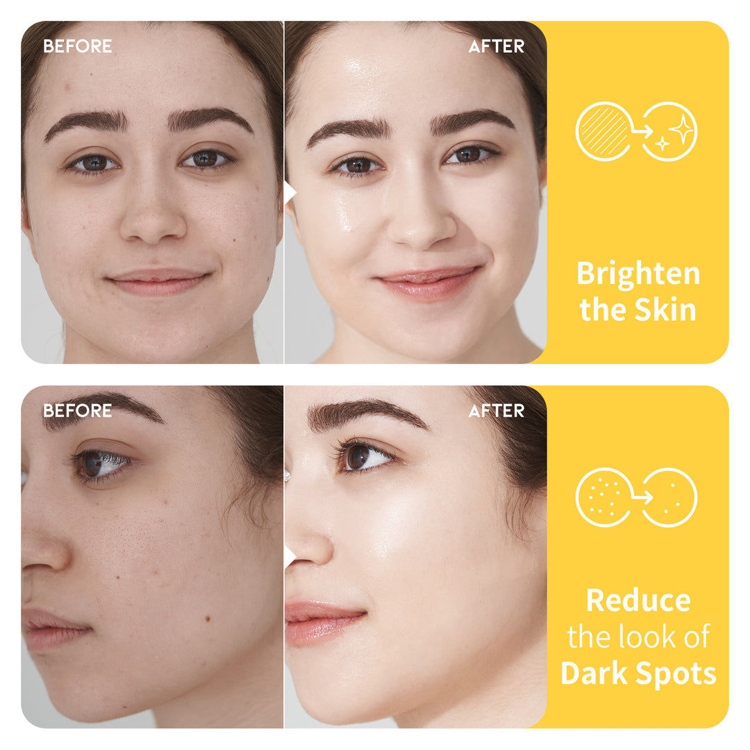 #OOTD Dark Spot Vitamin C Toner 250ml