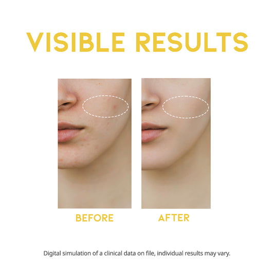 #OOTD Dark Spot Vitamin C Serum 50ml