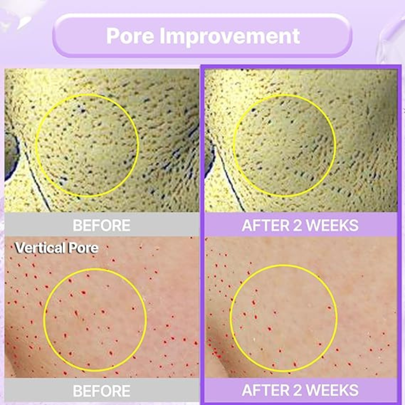 BIOHEAL BOH Probioderm™ Collagen Remodeling Cream 50ml