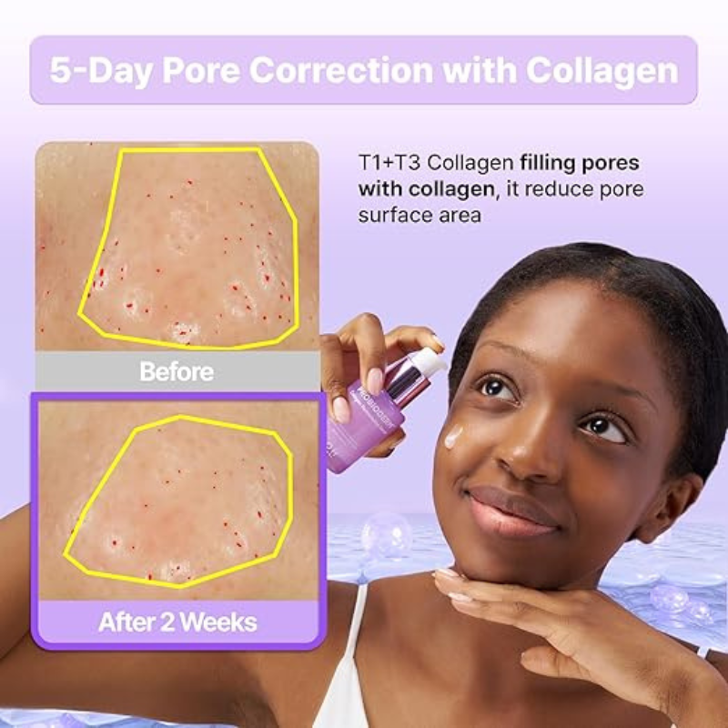 BIOHEAL BOH Probioderm™ Collagen Remodeling Serum 30ml