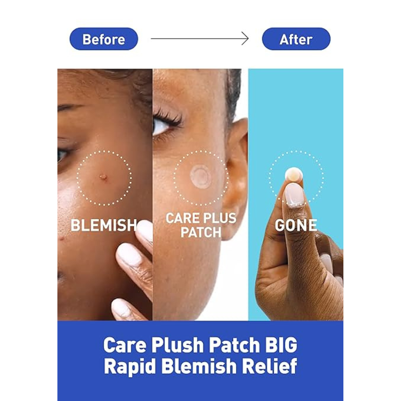 CARE PLUS Scar Cover Spot Patch Big 81pcs