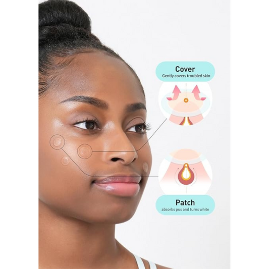 CARE PLUS Scar Cover Spot Patch Big 81pcs