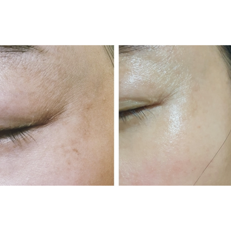 BLANC DUBU Nuborn Cell Idebenone Double Shot Whitening Ampoule