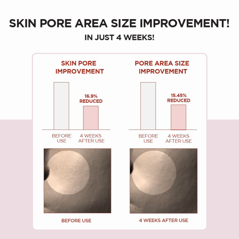 SKIN1004 Madagascar Centella Poremizing Fresh Ampoule 30ml/50ml/100ml(Cruelty-Free)