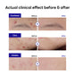 MEDIHEAL Derma Clear Teatree Trouble Spot Patch