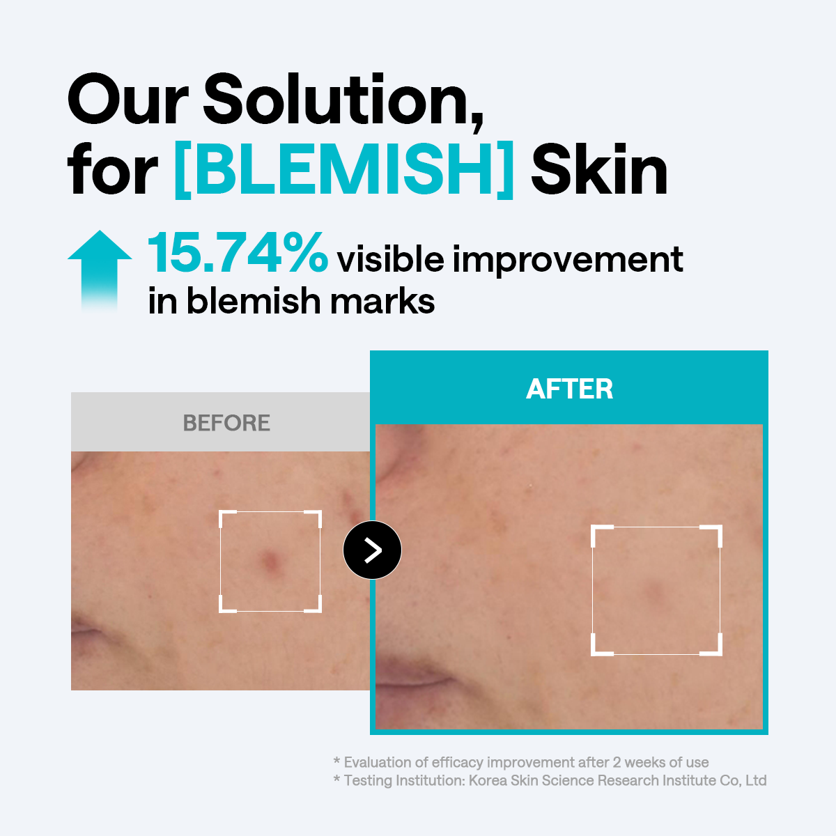 Mediheal Madecassoside Blemish Pad (SET)