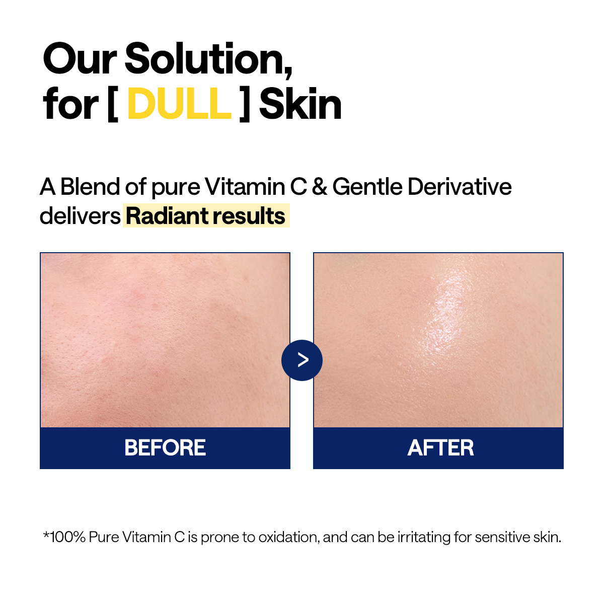 [Sachet] Mediheal Vitamin C Brightening Serum