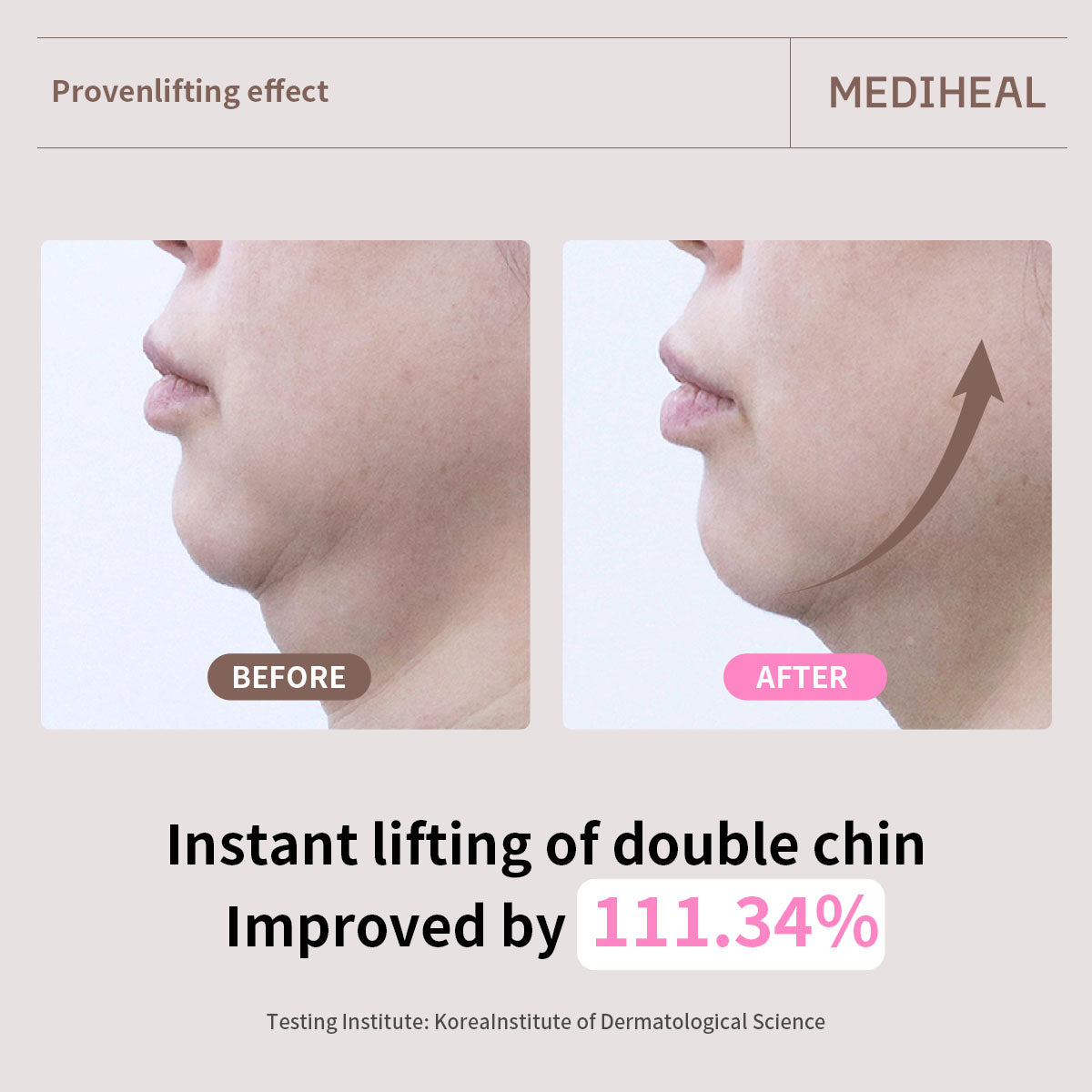 MEDIHEAL Retinol Collagen Ampoule Lifting Mask 4P