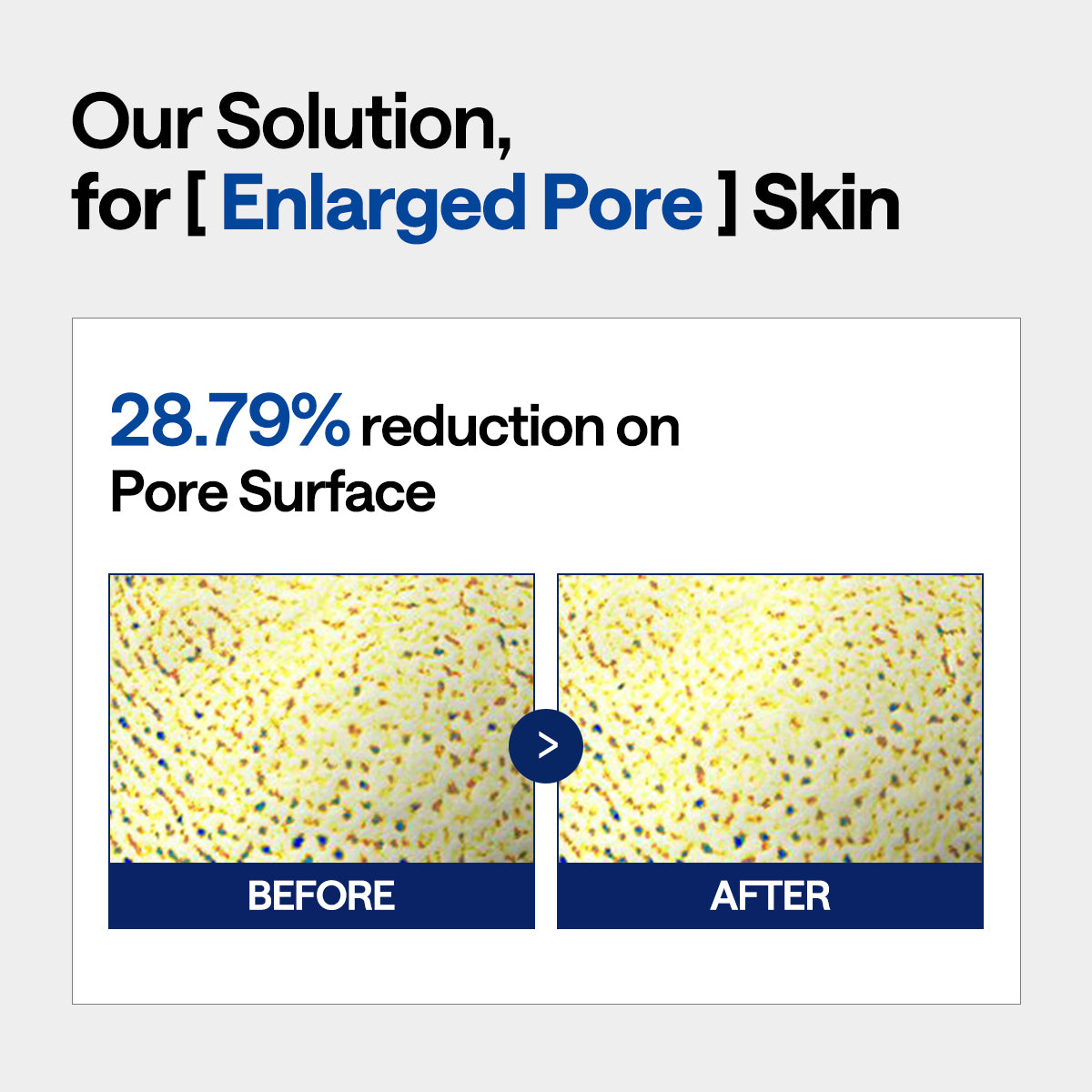 MEDIHEAL Spicule Pore Tighterning System 1 (Ver.2) - 1ea