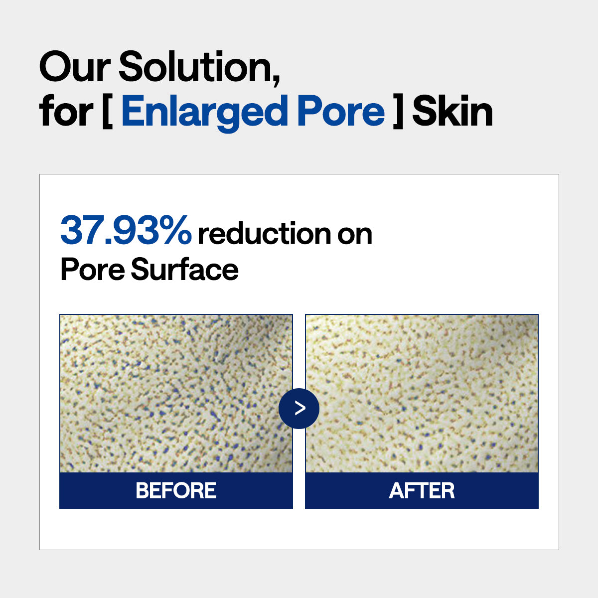 MEDIHEAL Spicule Pore Tighterning System 2 - 10ea