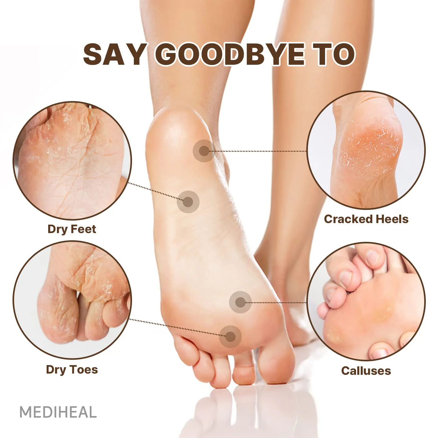 MEDIHEAL Derma Layer Foot Mask - 5ea