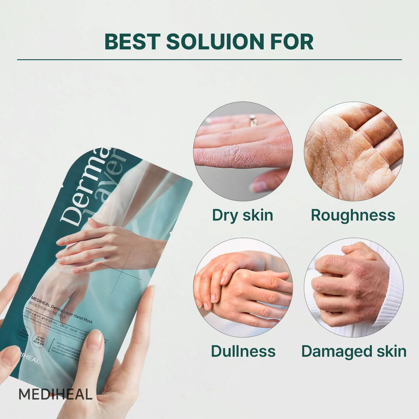 MEDIHEAL Derma Layer Hand Mask - 5ea