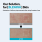 MEDIHEAL MADECASSOSIDE WRAPPING SERUM MASK_BLEMISH REPAIR (4P)