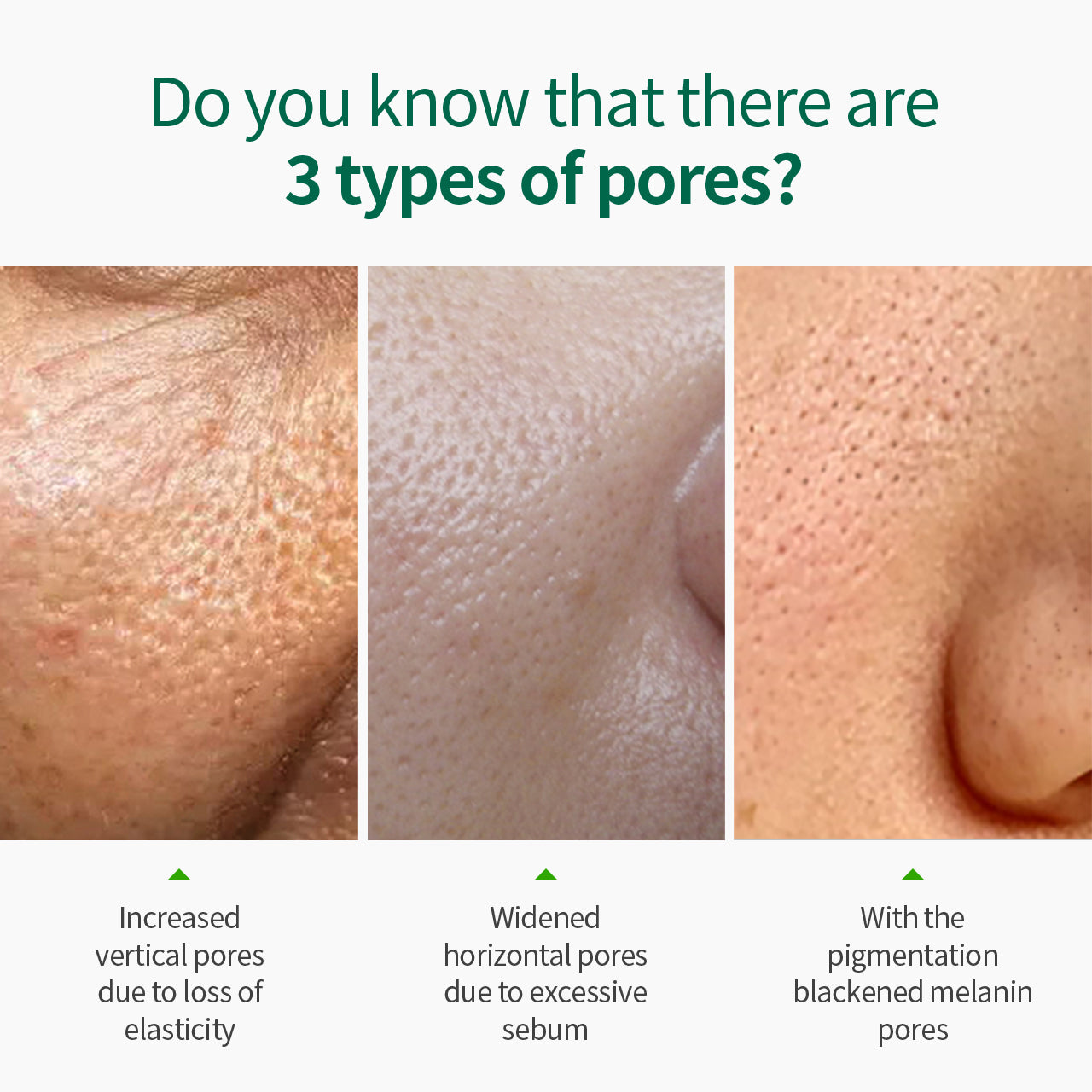 SUNGBOON EDITOR Green Tomato Pore Lifting Ampoule (30ml)